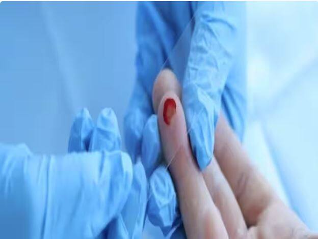 health tips iitr new kit to check hemoglobin level in body ਸਸਤਾ ਤੇ ਦੇਸੀ 'ਜੁਗਾੜ'...10 ਰੁਪਏ 'ਚ ਦੱਸੇਗਾ ਸਰੀਰ 'ਚ ਖ਼ੂਨ ਦੀ ਕਮੀ ਹੈ ਜਾਂ ਨਹੀਂ