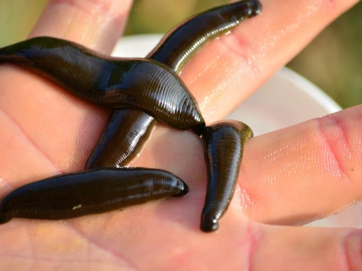 Why does pouring salt on a leech kill it know the reason behind this जोंक पर नमक डाल दें तो वह मर क्यों जाती है? क्या है इसका कारण?