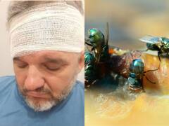 Shocking News: ਕੰਨਾਂ ਵਿੱਚ ਵਧ ਰਿਹਾ ਸੀ ਮੱਖੀਆਂ ਦਾ ਸਾਰਾ ਟੱਬਰ! ਤੇਜ਼ ਦਰਦ ਤੋਂ ਬਾਅਦ ਹਸਪਤਾਲ ਪਹੁੰਚਿਆ ਵਿਅਕਤੀ, ਡਾਕਟਰਾਂ ਦੇ ਉੱਡ ਗਏ ਹੋਸ਼