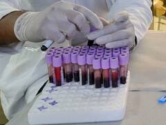 भीषण गर्मी में कानपुर के ब्लड बैंक में खून का संकट, टालनी पड़ रही मरीजों की सर्जरी