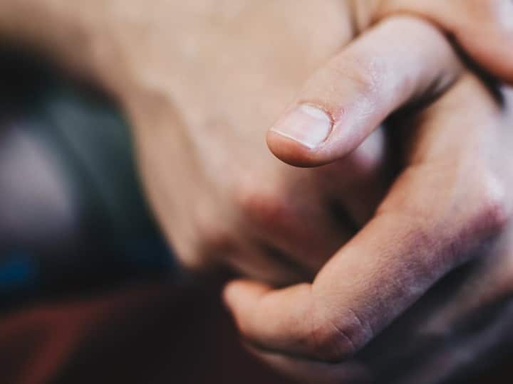 Why do white marks form on the nails what are they called know here नाखून पर सफेद निशान क्यों बन जाते हैं? पढ़िए पिछले हिस्से पर बने निशान को क्या कहते हैं