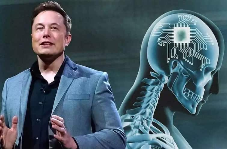 Elon Musk : Neuralink will soon Start its First Clinical Human Trial may End up This Year Elon Musk : લોકોના મગજમાં 'છેડછાડ' કરશે એલન મસ્ક, જાણો ક્યારે લેશે ટ્રાયલ