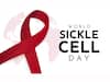 World Sickle Cell Day 2023: Overcoming Challenges And Improving Care In Low-Income Regions