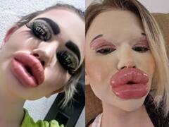 लाखों खर्च करके बढ़ाया लिप्स का साइज, अब बॉयफ्रेंड ढूंढ रही हैं ये महिला... शायद ही देखे होंगे इतने बड़े होंठ?