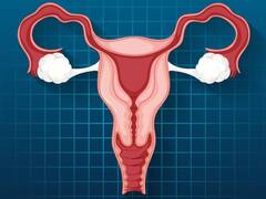 International Yoga Day 2023: Uterus को हेल्दी बनाए रखते हैं ये दो योग आसन, ओवेरियन कैंसर का नहीं होगा खतरा