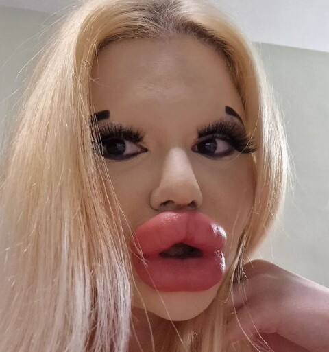 ਸ਼ਾਇਦ ਹੀ ਤੁਸੀਂ ਇੰਨੇ ਵੱਡੇ ਬੁੱਲ੍ਹ ਦੇਖੇ ਹੋਣਗੇ?