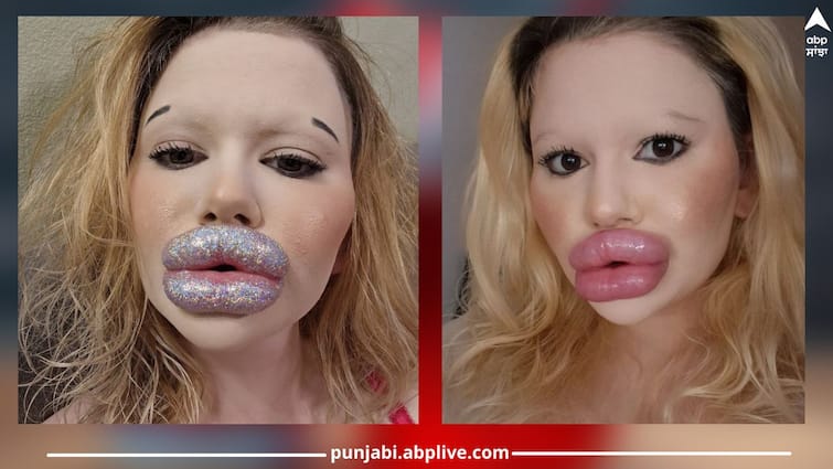 biggest-lips-of-women-in-the-world-social-media-influencer-details-inside ਹੈਰਾਨ ਕਰ ਦੇਣ ਵਾਲਾ ਮਾਮਲਾ! ਲੱਖਾਂ ਖਰਚ ਕੇ ਬੁੱਲ੍ਹਾਂ ਦਾ ਵਧਾਇਆ ਸਾਇਜ਼, ਹੁਣ ਲੱਭ ਰਹੀ ਹੈ ਬੁਆਏਫ੍ਰੈਂਡ... ਸ਼ਾਇਦ ਹੀ ਤੁਸੀਂ ਇੰਨੇ ਵੱਡੇ ਬੁੱਲ੍ਹ ਦੇਖੇ ਹੋਣਗੇ?