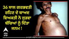 Pregnant Man: 36 ਸਾਲ ਗਰਭਵਤੀ ਰਹਿਣ ਦੇ ਬਾਅਦ ਵਿਅਕਤੀ ਨੇ ਜੁੜਵਾ ਬੱਚਿਆਂ ਨੂੰ ਦਿੱਤਾ ਜਨਮ ! ਡਾਕਟਰ ਵੀ ਰਹਿ ਗਏ ਦੰਗ