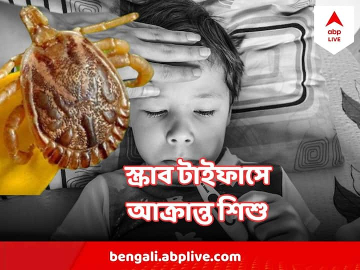 ট্রম্বিকিউলিড মাইটস নামে এক ধরনের মাকড়ের কামড়ে শরীরে ঢোকে স্ক্রাব টাইফাস ব্যাকটেরিয়া!