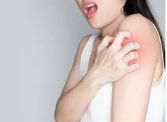 ਗਰਮੀਆਂ ‘ਚ ਤੁਹਾਨੂੰ ਵੀ ਹੁੰਦੀ ਸਕਿਨ ਐਲਰਜੀ...ਇਹ 6 ਟਿਪਸ ਆਉਣਗੇ ਕੰਮ