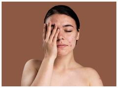 सफेद ज़हर कहलाती है चीनी, ज्यादा खाने से चेहरे पर दिखने लगते हैं अनचाहे असर