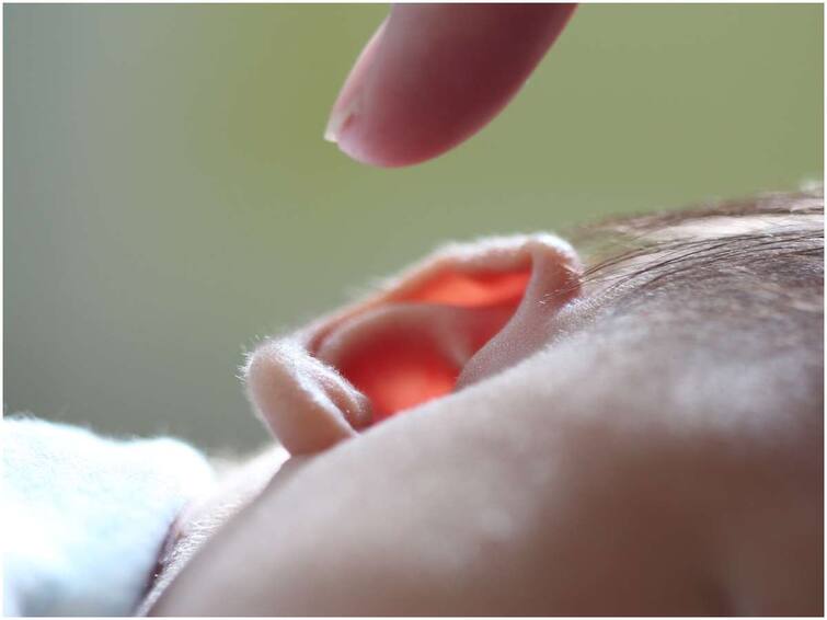 Are frequent ear infections bothering you? Reduce with these home tips Ayurvedam: చెవి పోటు తరచూ వచ్చి ఇబ్బంది పెడుతోందా? ఇలా ఇంటి చిట్కాలతో తగ్గించుకోండి