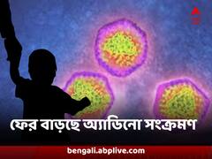 ফিরছে জ্বর, সর্দি, কাশি, শিশুদের মধ্যে ফের বাড়ছে অ্য়াডিনো ভাইরাসের সংক্রমণ