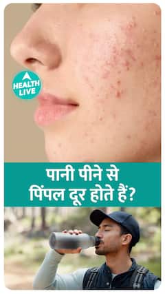 पानी पीने से Pimple दूर होते हैं?