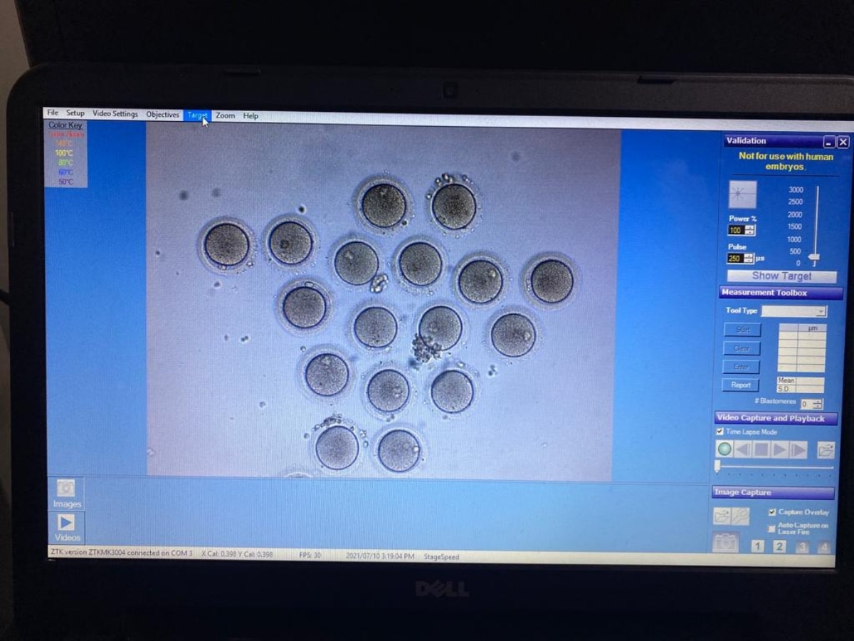 Mature oocytes observed under a microscope before being frozen (Photo credit: ABP Live via special arrangement with Infinite Fertility Wellness Centre)