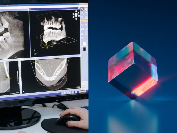 How to identify real or fake Diamond it can be check by done by X ray अगर हीरे का एक्सरे किया जाए तो क्या होगा? अगर इस तरह की फोटो आई तो समझिए असली है