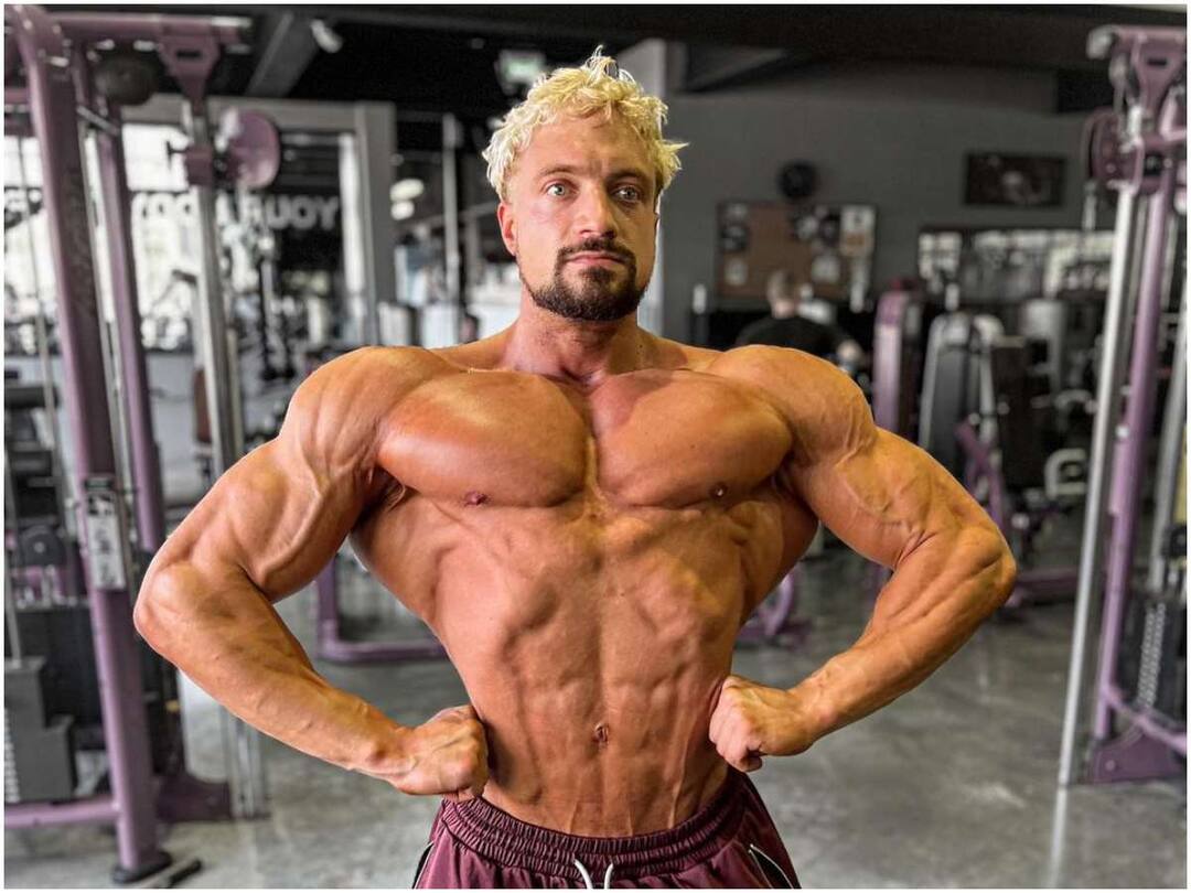 Famous Bodybuilder Who Died Young Due to Aneurysm Problem, What is Aneurysm? అనూరిజమ్‌తో చిన్న వయసులోనే మరణించిన ప్రఖ్యాత బాడీబిల్డర్, ఏమిటి అనూరిజమ్
