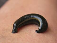 बारिश में परेशान कर रहे खून चूसने वाले जोंक? इन तरीकों से पाएं इनसे छुटकारा