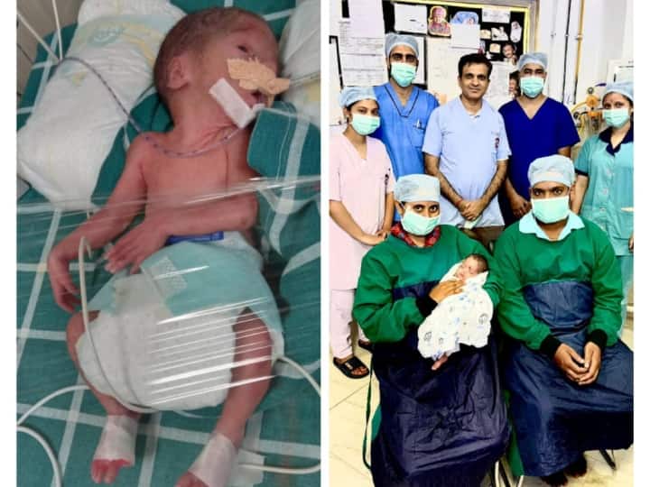 Jammu Kashmir Miracle of doctors in Jammu and Kashmir saved a 24 weeks child born ann Jammu Kashmir: जम्मू-कश्मीर में डॉक्टरों का चमत्कार, 24 हफ्ते में ही जन्मे बच्चे को बचाया