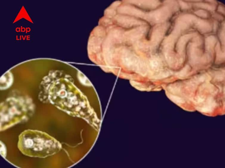 Brain Eating Amoeba Know About This Disease Cause Symptoms Other Details Brain Eating Amoeba:মস্তিষ্কখেকো অ্যামিবার সংক্রমণ, প্রাণ হারাল কেরলের কিশোর, আপনি সাবধান তো?