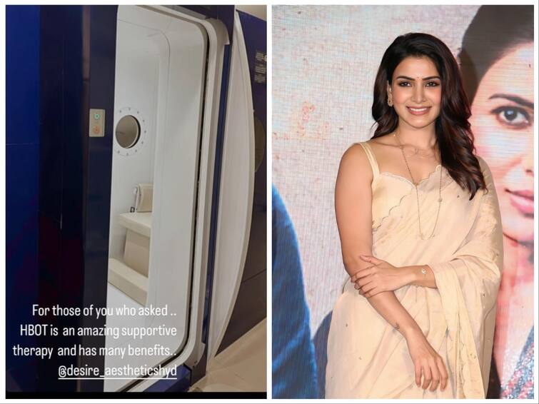 Samantha Ruth Prabhu shares on taking hyperbaric therapy details here Samantha: இவ்வளவு ஆபத்தான சிகிச்சையா? சமந்தா மேற்கொள்ளும் சிகிச்சை என்ன தெரியுமா? விபரம் இதோ..!