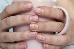 ਜੇ ਨਹੁੰਆਂ 'ਚ ਹੋ ਰਹੇ ਅਜਿਹੇ ਬਦਲਾਅ, ਤਾਂ ਤੁਰੰਤ ਹੋ ਜਾਓ ਸਾਵਧਾਨ, ਗੰਭੀਰ ਬੀਮਾਰੀਆਂ ਦੇ ਸੰਕੇਤ!