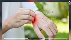 ਬਾਰਸ਼ ਦੇ ਕਹਿਰ 'ਚ ਡੇਂਗੂ ਦਾ ਖਤਰਾ! ਇਹ ਲੱਛਣ ਵੇਖਦੇ ਹੀ ਹੋ ਜਾਓ ਸਾਵਧਾਨ, ਜਾਣੋ ਬਚਾਅ ਦੇ ਉਪਾਅ