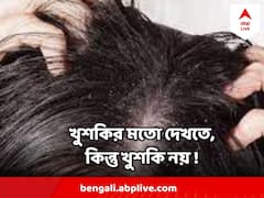 Dandruff : চটচটে খুশকির মতো দেখতে কিন্তু সাধারণ খুশকি নয় ! জেনে নিন চিকিৎসকরা কী বলছেন !