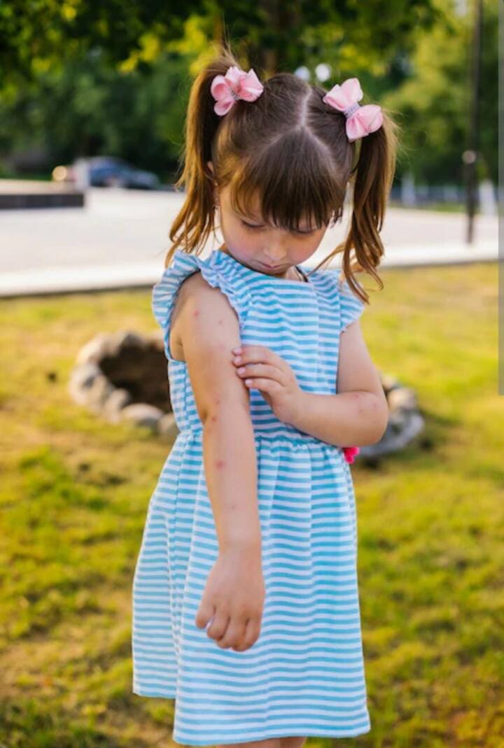 बच्चे को डेंगू से बचाना है तो उन्हें डेंगू के खतरे के बारे में एजुकेट करना भी जरूरी है. उन्हें यह भी सिखाए की बरसात के मौसम में किन जगहों पर जाने से डेंगू फैल सकता है.
