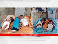 मेळघाटातील दुनी इथल्या महिलेने दिला चार मुलींना जन्म, बाळ आणि आई सुखरुप