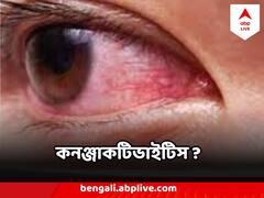 বাড়ছে কঞ্জাঙ্কটিভাইটিস, এই উপসর্গগুলি দেখলেই সতর্ক হোন, কী করবেন, কী করবেন না