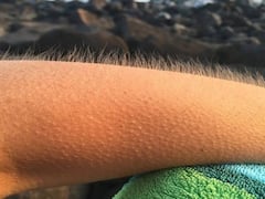 क्या आप जानते हैं इंसान के रोंगटे क्यों खड़े हो जाते हैं? जानिए शरीर के लिए ये क्यों और कैसे है फायदेमंद?