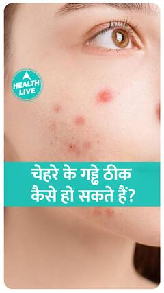 Face के गड्ढे करते हैं परेशान, तो ये जान लें.