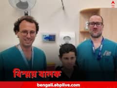 সাইকেলে ধাক্কা গাড়ির, অস্থিসন্ধির সঙ্গে আলগা লেগে ছিল বালকের বিচ্ছিন্ন মাথা, ফের জুড়ে দিলেন চিকিৎসকরা