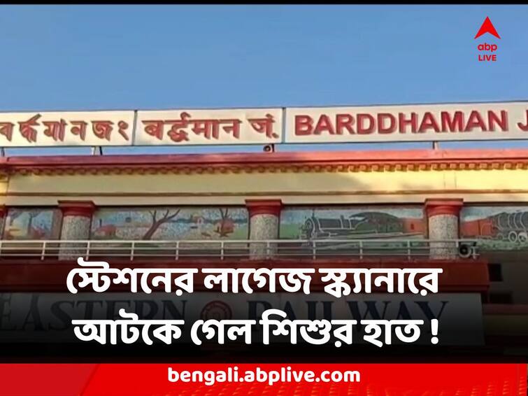 Purba Bardhaman Child hand stuck in Station Luggage Scanner recovered Purba Burdhaman News : স্টেশনের লাগেজ স্ক্যানারে আটকে গেল শিশুর হাত ! বর্ধমানে চাঞ্চল্য