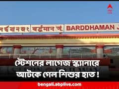 স্টেশনের লাগেজ স্ক্যানারে আটকে গেল শিশুর হাত ! বর্ধমানে চাঞ্চল্য