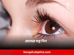বাড়ছে কনজাংটিভাইটিসের প্রকোপ, কীভাবে সুস্থ রাখবেন নিজেকে?