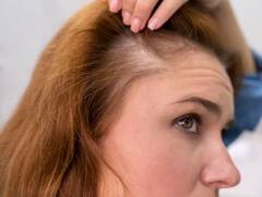 ਮਾਨਸੂਨ 'ਚ ਝੜਦੇ ਵਾਲ? ਤਾਂ ਅਪਣਾਓ ਇਹ ਘਰੇਲੂ ਨੁਸਖੇ, ਛੇਤੀ ਹੀ ਮਿਲੇਗਾ ਛੁਟਕਾਰਾ