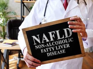 Fatty Liver: फॅटी लिव्हर डिसीज असेल तर आहार कसा असावा, घ्या जाणून