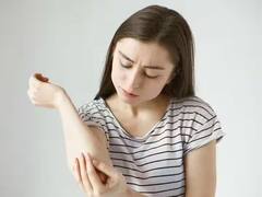 पावसात भिजल्यावर खाज सुटू लागली तर लगेच करा 'हा' उपाय; समस्या दूर होईल