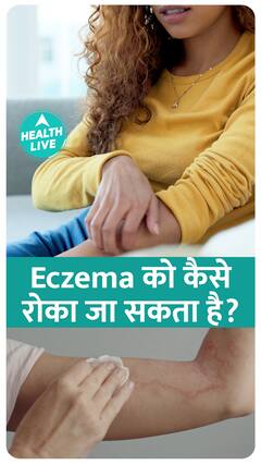 Is eczema a serious disease?