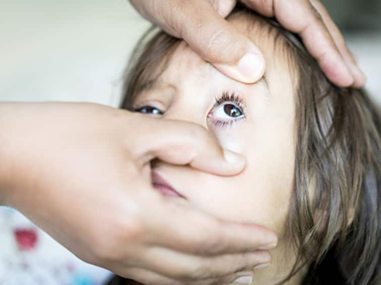 Joy Bangla Conjunctivitis Cases Surge In West Bengal Kolkata By New Adenovirus Strain Know Symptoms Recovery Delhi Conjunctivitis Spike Bengal: Sudden Surge Of Conjunctivitis Cases In Kolkata, Experts Cite New Adenovirus Strain