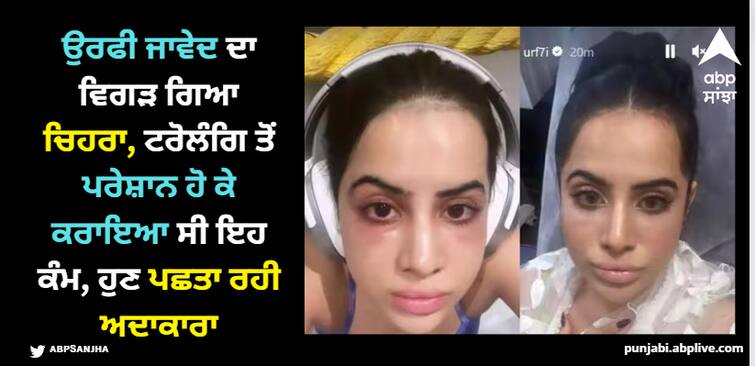 uorfi-javed-under-eye-filler-lip-filler-horribly-gone-wrong-actress-shared-weird-face-photo-on-instagram Uorfi Javed: ਉਰਫੀ ਜਾਵੇਦ ਦਾ ਵਿਗੜ ਗਿਆ ਚਿਹਰਾ, ਟਰੋਲਿੰਗ ਤੋਂ ਪਰੇਸ਼ਾਨ ਹੋ ਕੇ ਕਰਾਇਆ ਸੀ ਇਹ ਕੰਮ, ਹੁਣ ਪਛਤਾ ਰਹੀ ਅਦਾਕਾਰਾ