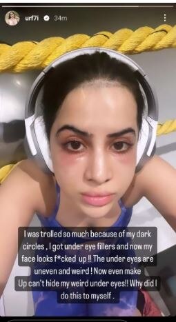 Uorfi Javed Regrets Getting Under-Eye Fillers After Getting Trolled: ‘Why Did I Do This To Myself?’