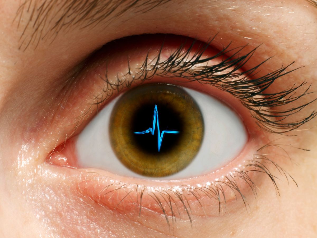 What Are Arcus Senilis and Corneal Arcus? — All About Vision