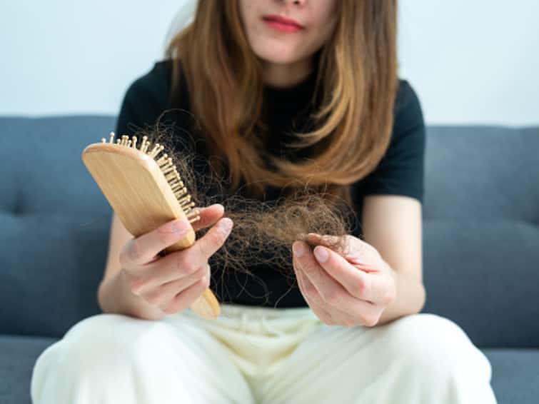 Causes of Hair Loss In Adults And Children And Food Items To Include In Diet Required To Prevent It Know The Causes of Hair Loss And Food Items Required In Diet To Prevent It