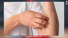 Syphilis Disease: ਕੋਰੋਨਾ ਮਗਰੋਂ ਸਿਫਿਲਿਸ ਦਾ ਕਹਿਰ! ਅਮਰੀਕਾ ਮਗਰੋਂ ਭਾਰਤ 'ਚ ਵੀ ਖ਼ਤਰਾ?