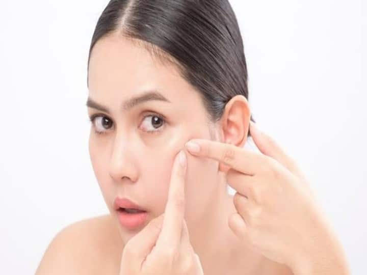 beauty skin care tips pimple popping side effects in hindi क्या आप भी टॉवल से दबाकर पिंपल्स फोड़ते हैं, तो जान लीजिए ऐसा करने से बढ़ सकते हैं कौन से 5 स्किन प्रॉब्लम्स