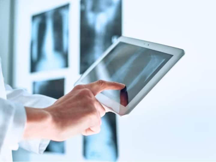 what is dexa scan Know when it is needed सीटी स्कैन तो सुना होगा लेकिन ये Dexa स्कैन क्या होता है? जानिए कब पड़ती है इसकी जरूरत