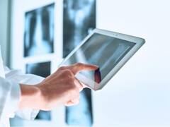 सीटी स्कैन तो सुना होगा लेकिन ये Dexa स्कैन क्या होता है? जानिए कब पड़ती है इसकी जरूरत